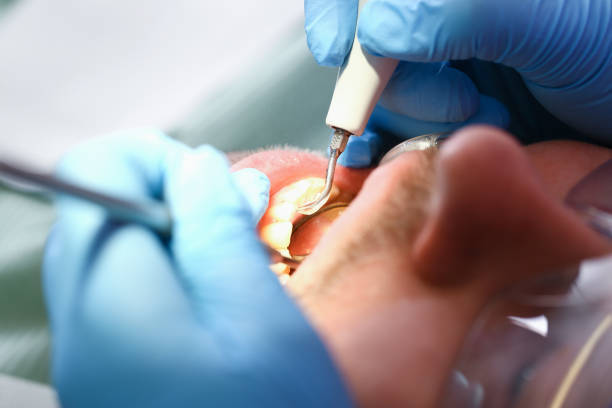 Best Cosmetic Emergency Dentistry in Newton, MS