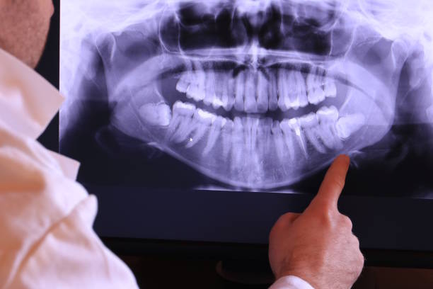 Best Emergency TMJ Treatment in Newton, MS